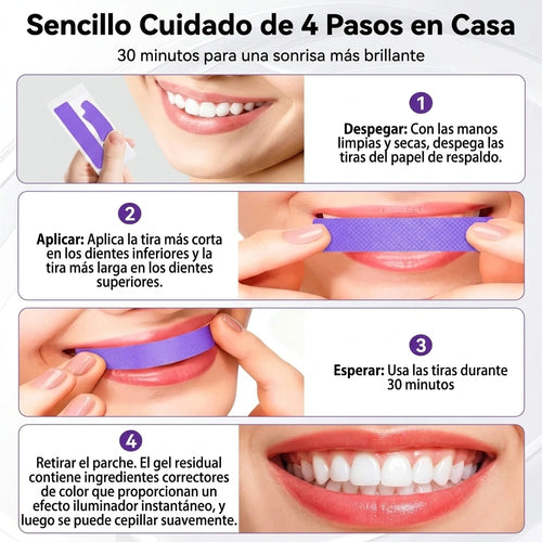 Bandas Blanqueadoras Dentales SmileKit x7